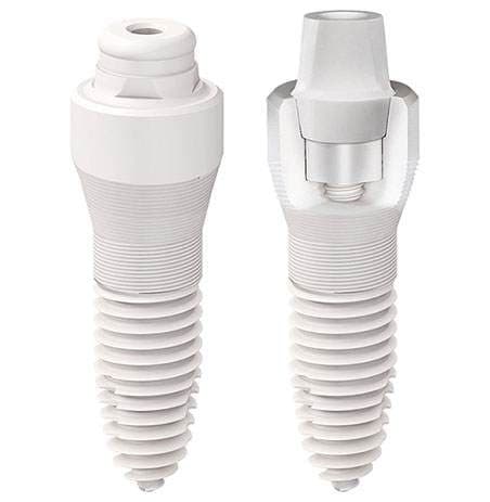 Keramikimplantate Keramikimplantate als teil der biologischen Zahnmedizin